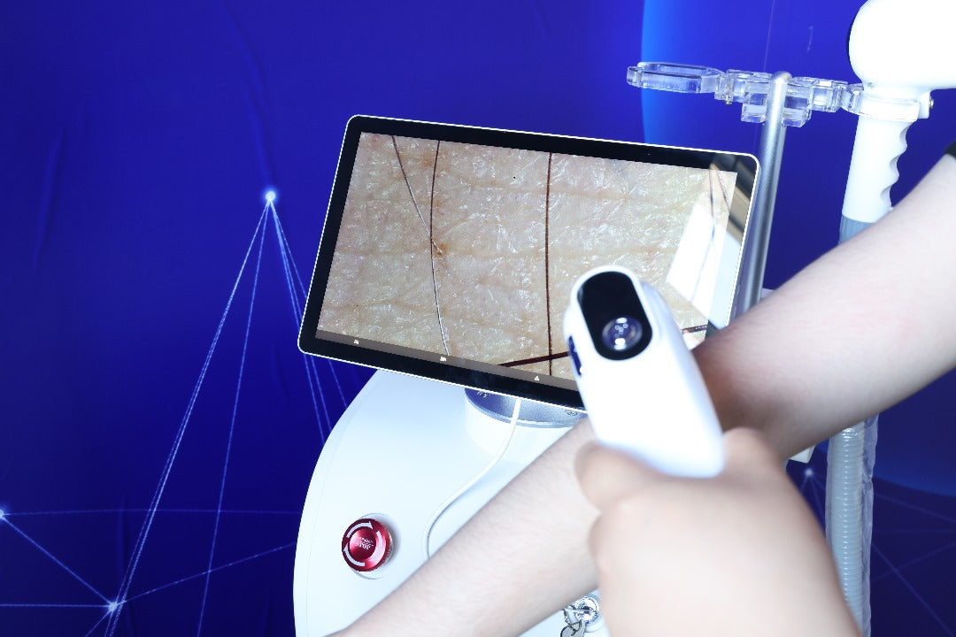 alpha-pro-ice-diode-laser-ontharingsapparaat-veilige-effectieve-ontharing-camera-huid-en-haar-analyse